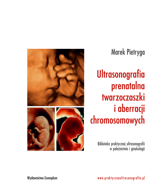 okladka – ultrasonografia prenatalna